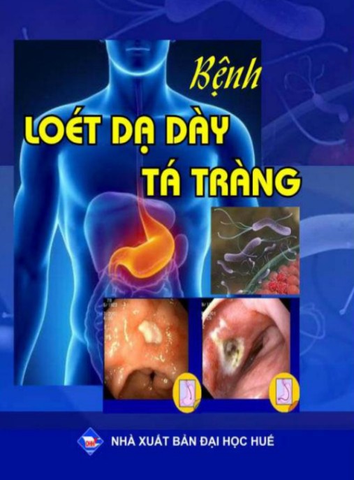Bện Loét Dạ Dày Tá Tràng