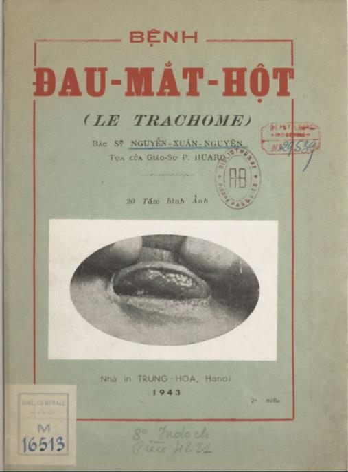 Bệnh Đau Mắt Hột