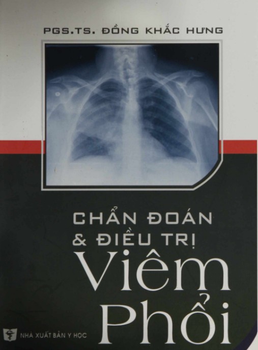 Chẩn Đoán Và Điều Trị Viêm Phổi