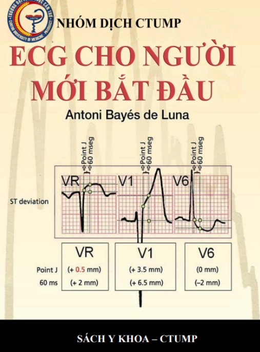 Ecg Cho Người Mới Bắt Đầu