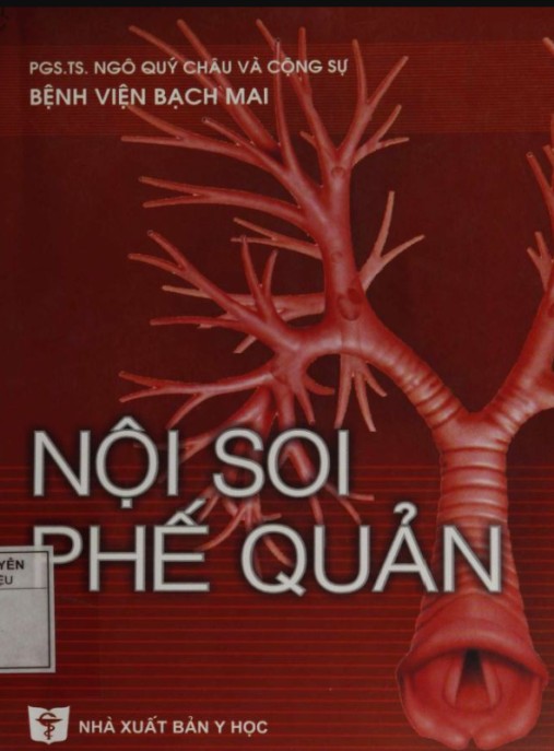 Nội Soi Phế Quản