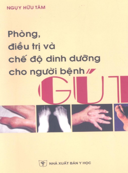 Phòng, Điều Trị Và Chế Độ Dinh Dưỡng Cho Người Bệnh Gút