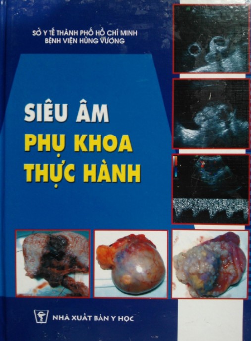 Siêu Âm Phụ Khoa Thực Hành