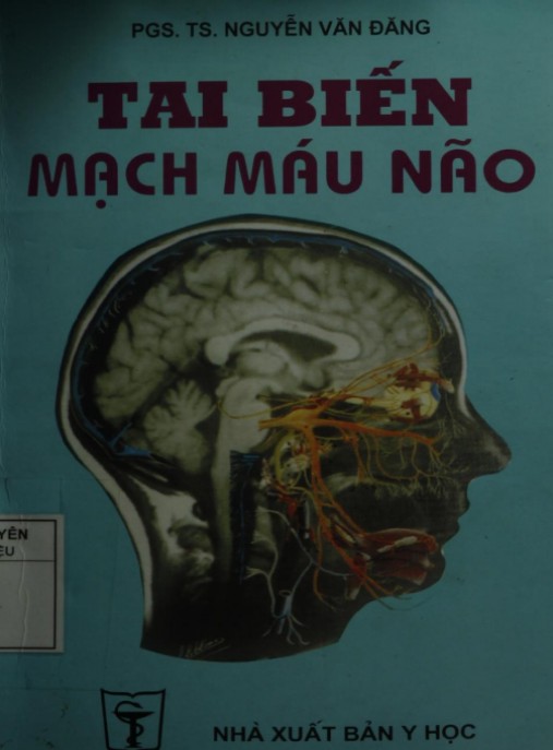 Tai Biến Mạch Máu Não